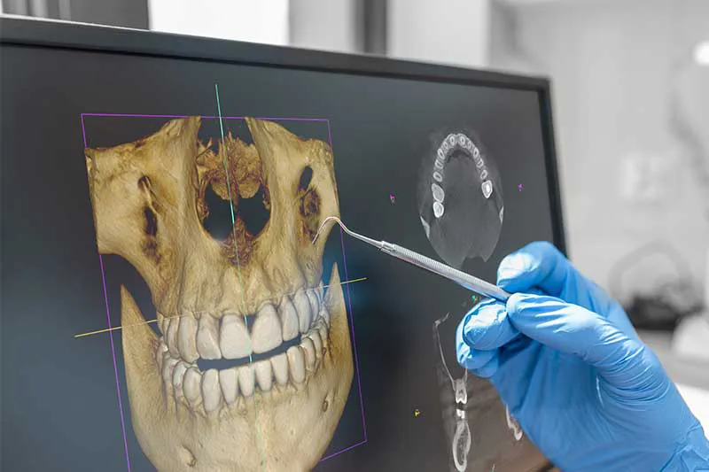 3D CBCT scanner