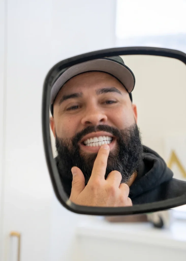 Actual Beverly Hills Dentistry Patient Examining Full Arch Implants In Mirror
